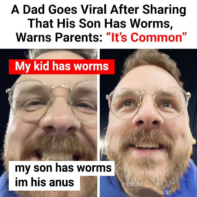 A Dad Goes Viral After Sharing That His Son Has Worms, Warns Parents: “It’s Common”